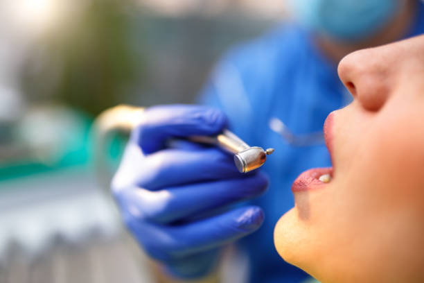 Best Teeth Whitening  in Fitchburg, WI